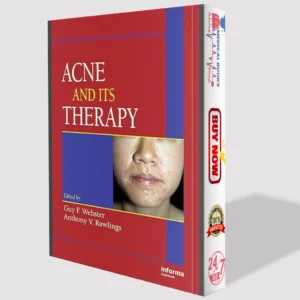 Acne and Its Therapy | Best Basic and Clinical Dermatology PDF