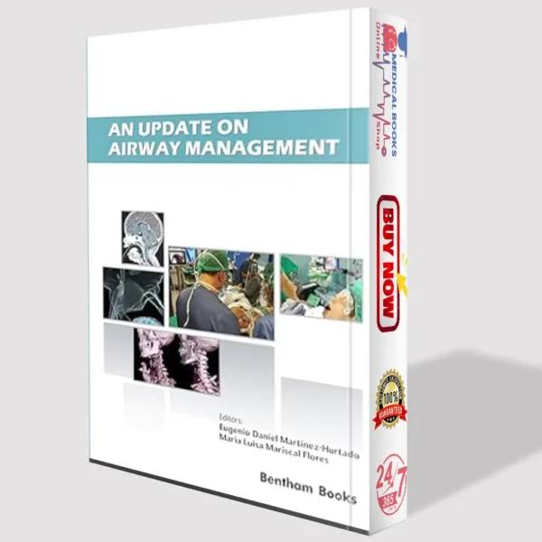 An Update on Airway Management