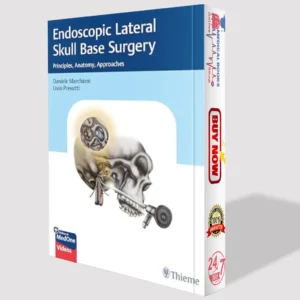 Endoscopic Lateral Skull Base Surgery