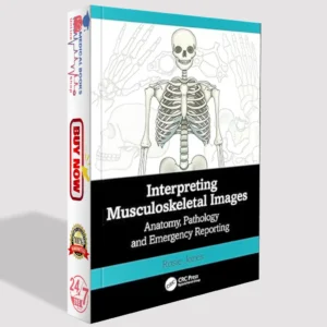 Interpreting Musculoskeletal Images